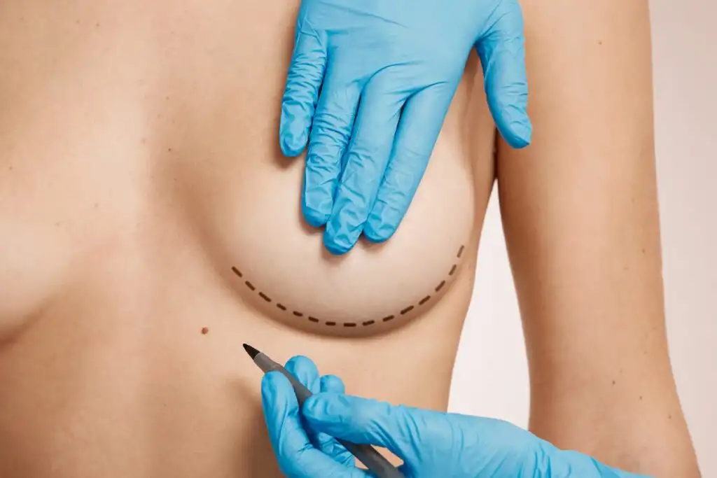 thumb nail breast argumentation