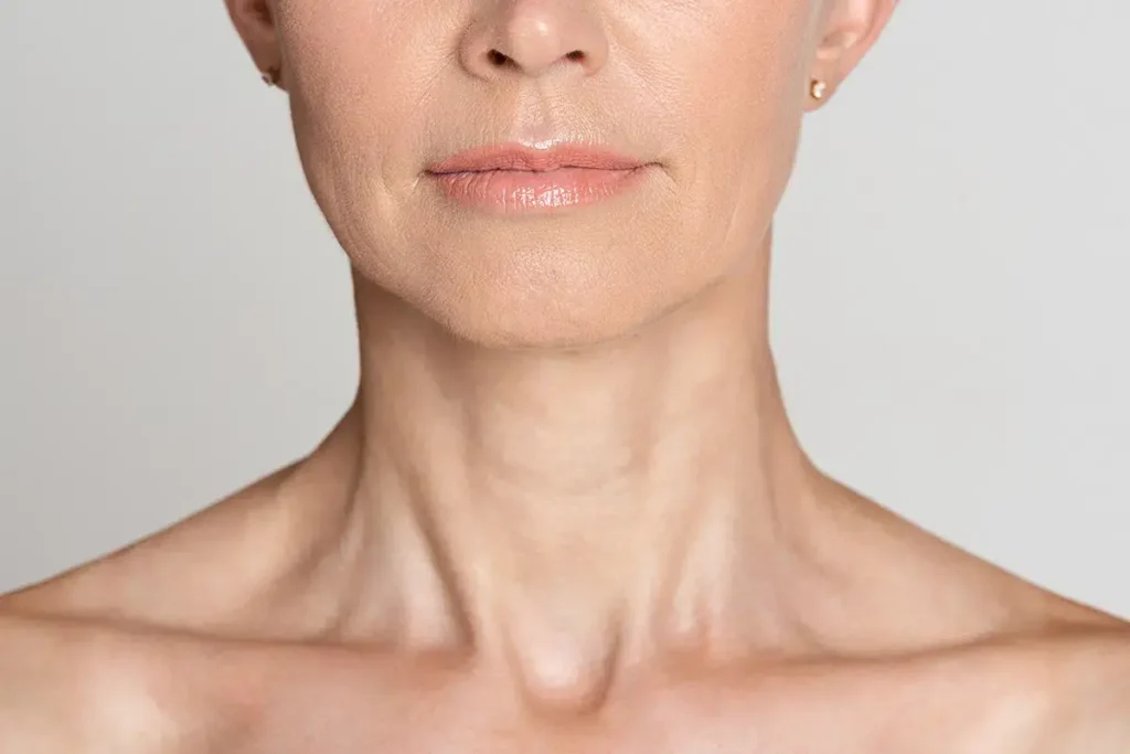 Non-surgical aesthetic treatments for neck wrinkles using thread lifting, collagen injections, and skin boosters for firmer skin