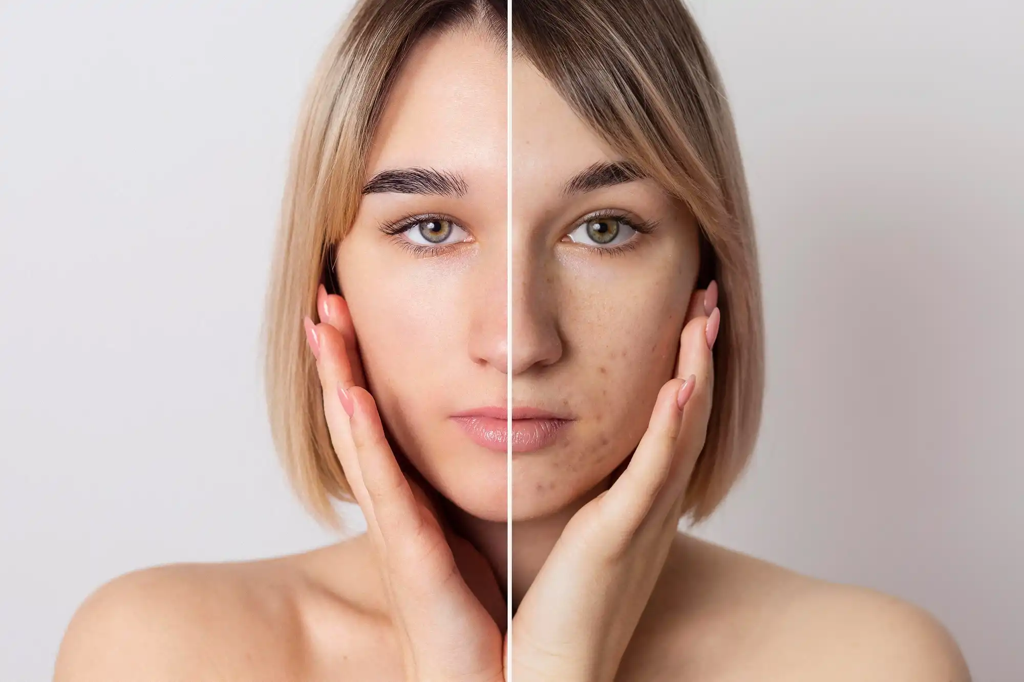 Helios III Laser – Powerful & Safe Precision Pigmentation and Skin Brightening Solution in Busan, Korea