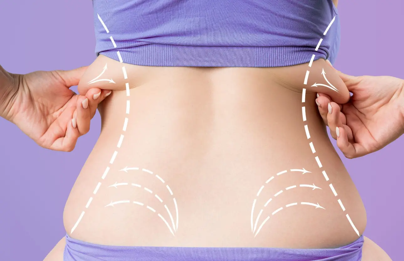 Revolutionary Water Jet – Deep Layer Liposuction in Busan for Safe, Targeted Fat Removal